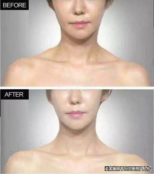 肩膀瘦了天鹅颈也出来了 气质立马就上来